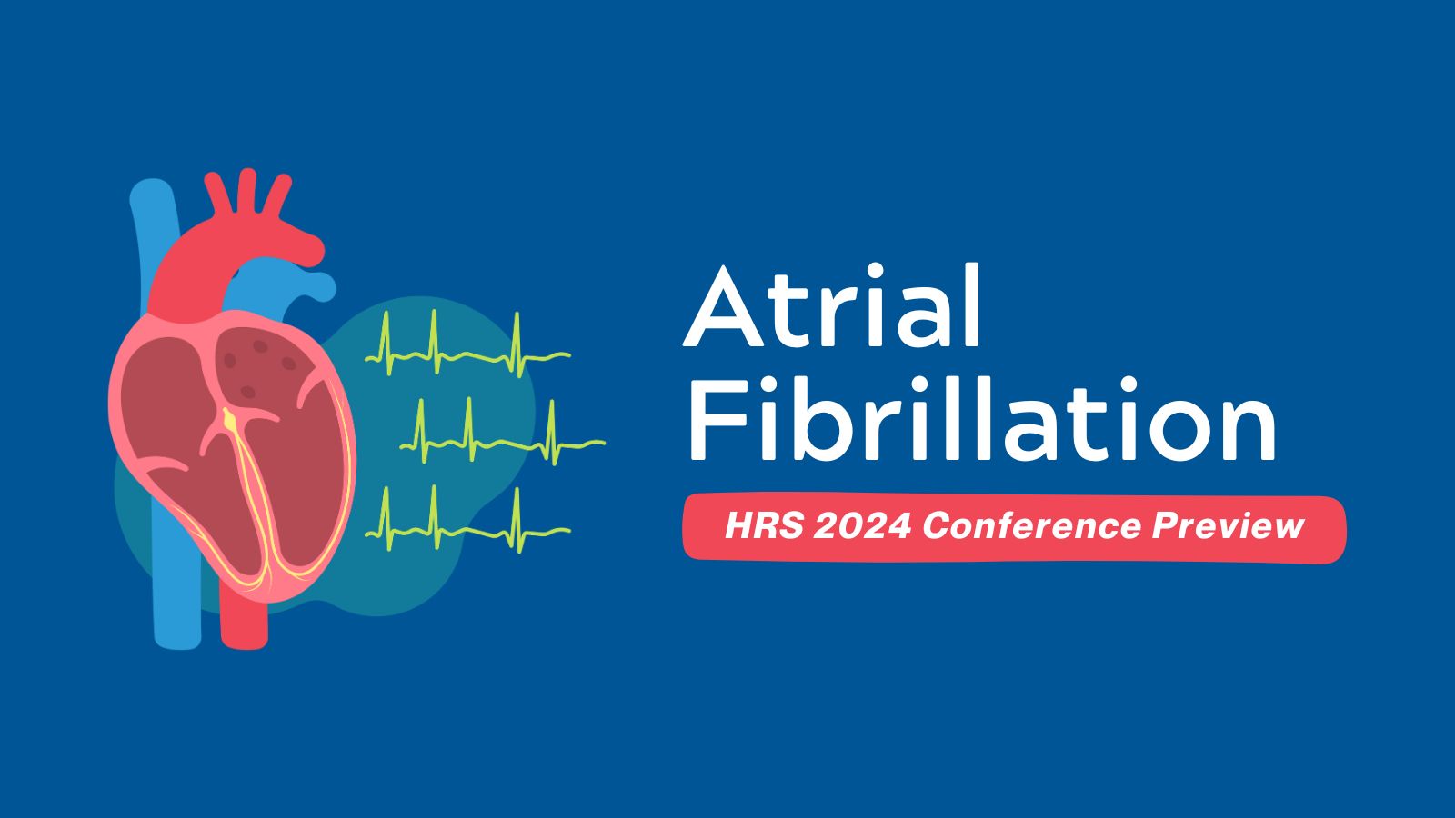HRS2024 Conference Preview - Atrial Fibrillation at Heart Rhythm 2024 featured image
