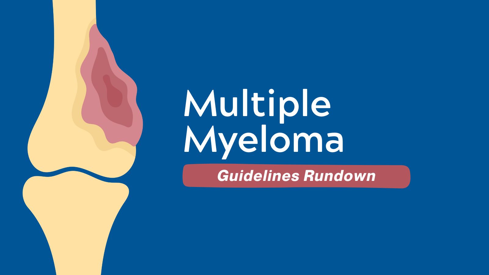 What’s New in Multiple Myeloma Guidelines - Guidelines Rundown featured image