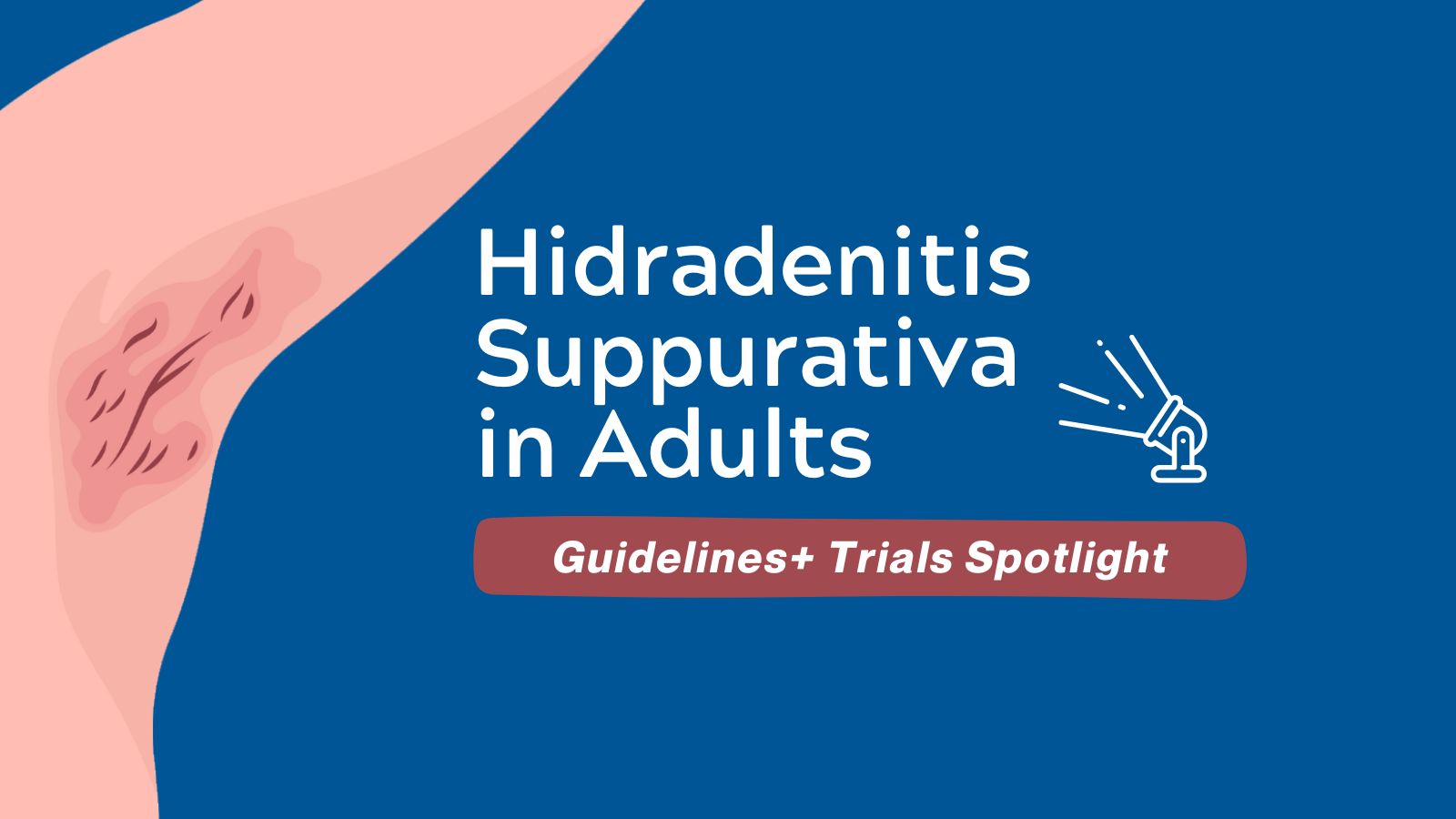 Hidradenitis Suppurativa in Adults - Guidelines+ Trials Rundown post image