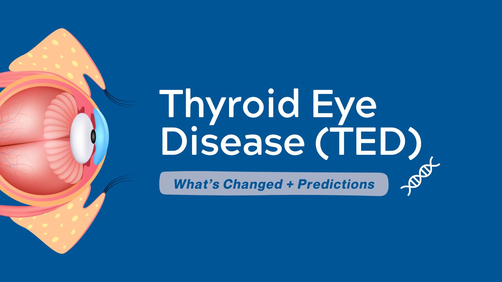 Thyroid Eye Disease (TED) - What’s Changed Since+ Predictions post image