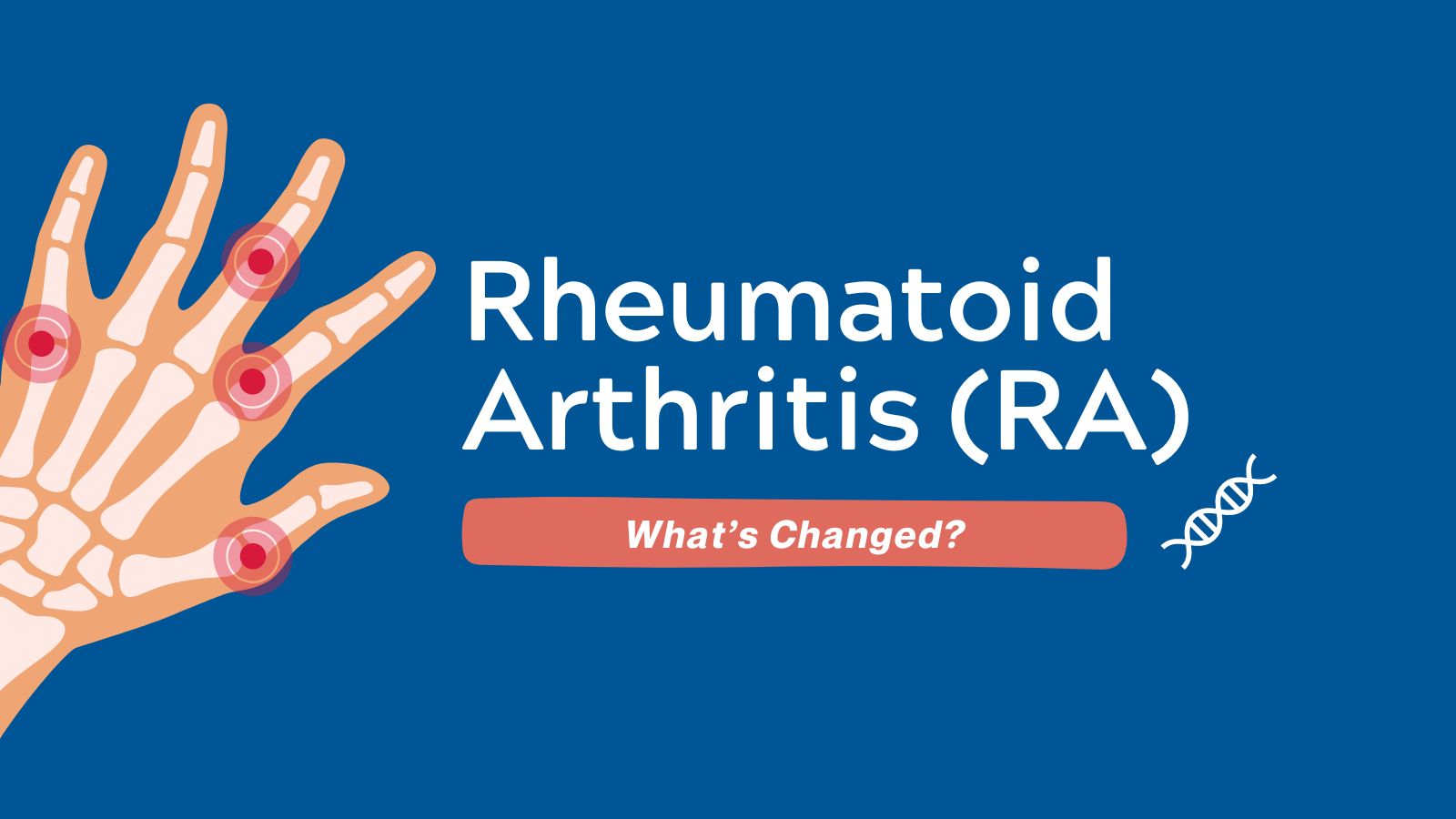 Rheumatoid Arthritis (RA) - What’s Changed? post image
