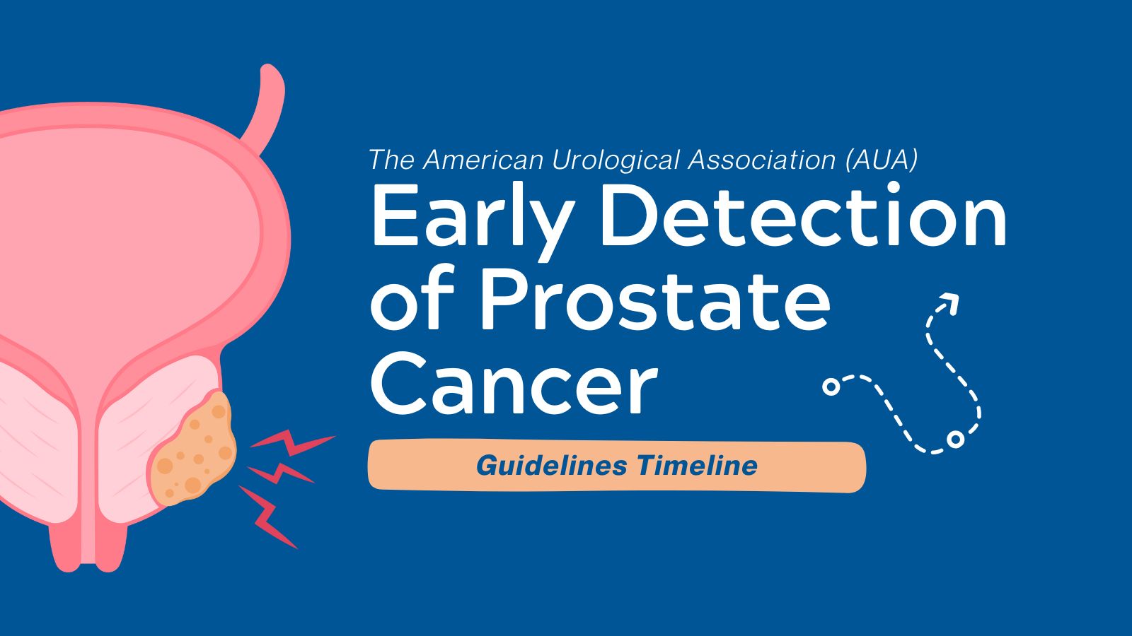 AUA’s Early Detection of Prostate Cancer 2013 vs 2023 - Guidelines Timeline featured image