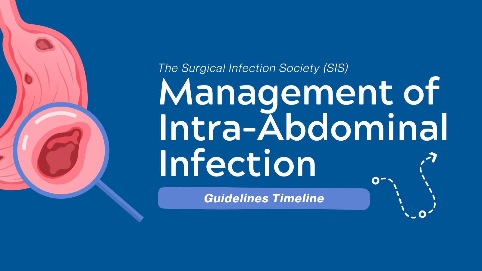 2024 SIS Management of Intra-Abdominal Infection Guideline: What's New &amp; What's Continued - Guidelines Timeline featured image