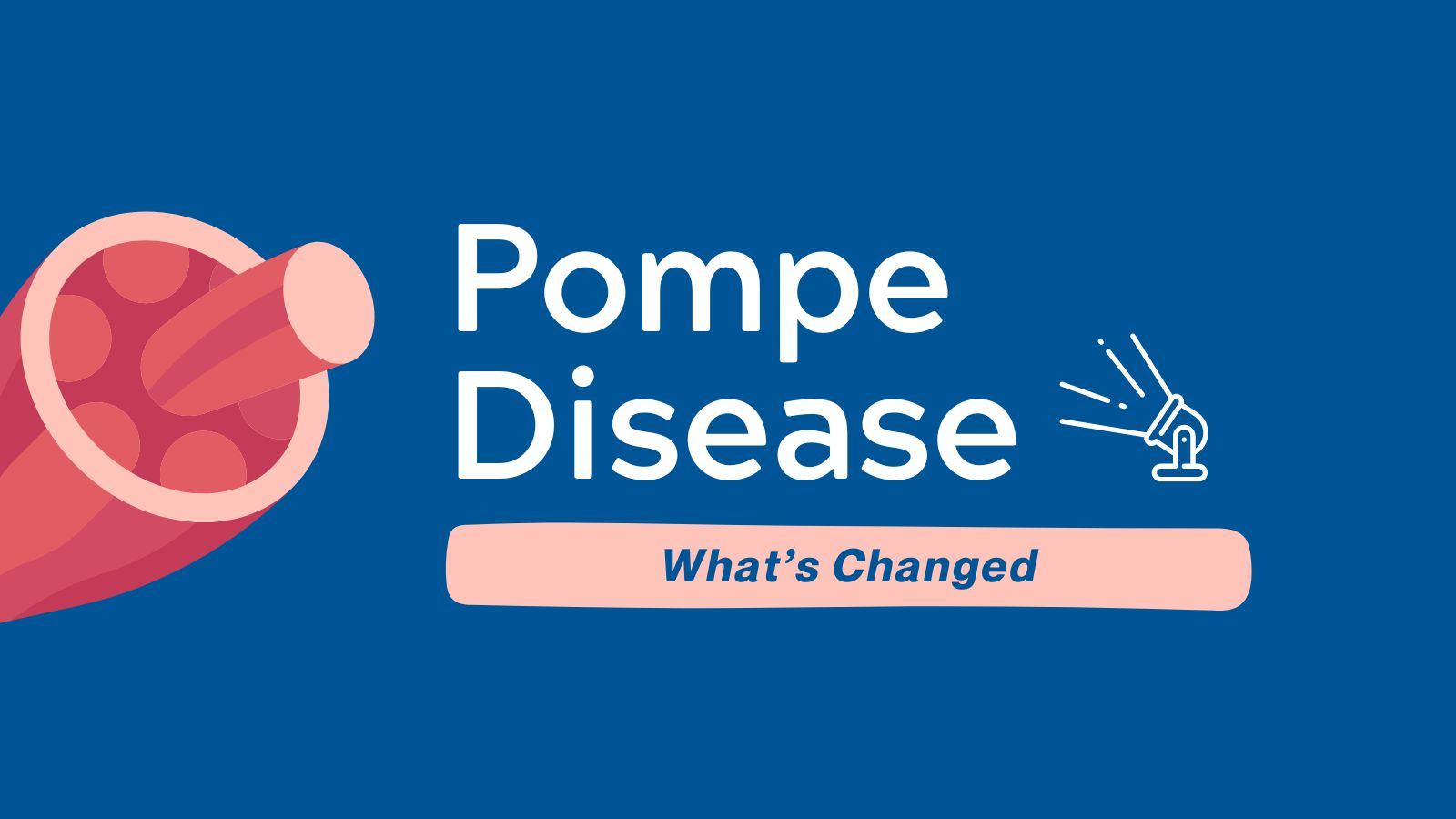 Pompe Disease - What's Changed? - Guideline Central