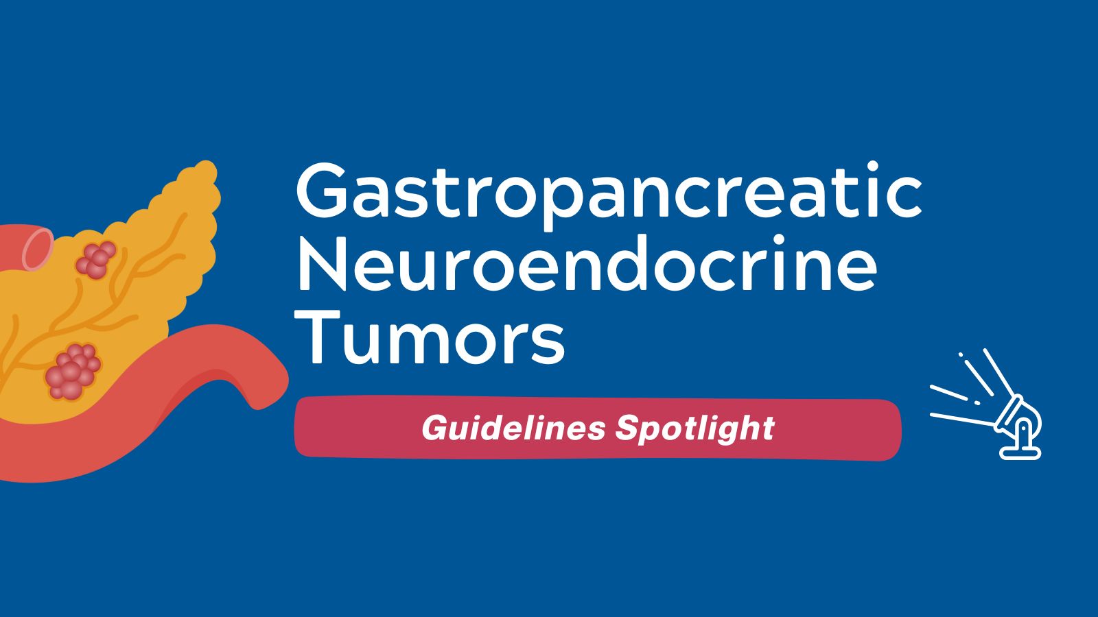Gastroenteropancreatic Neuroendocrine Tumors - Guidelines Spotlight featured image