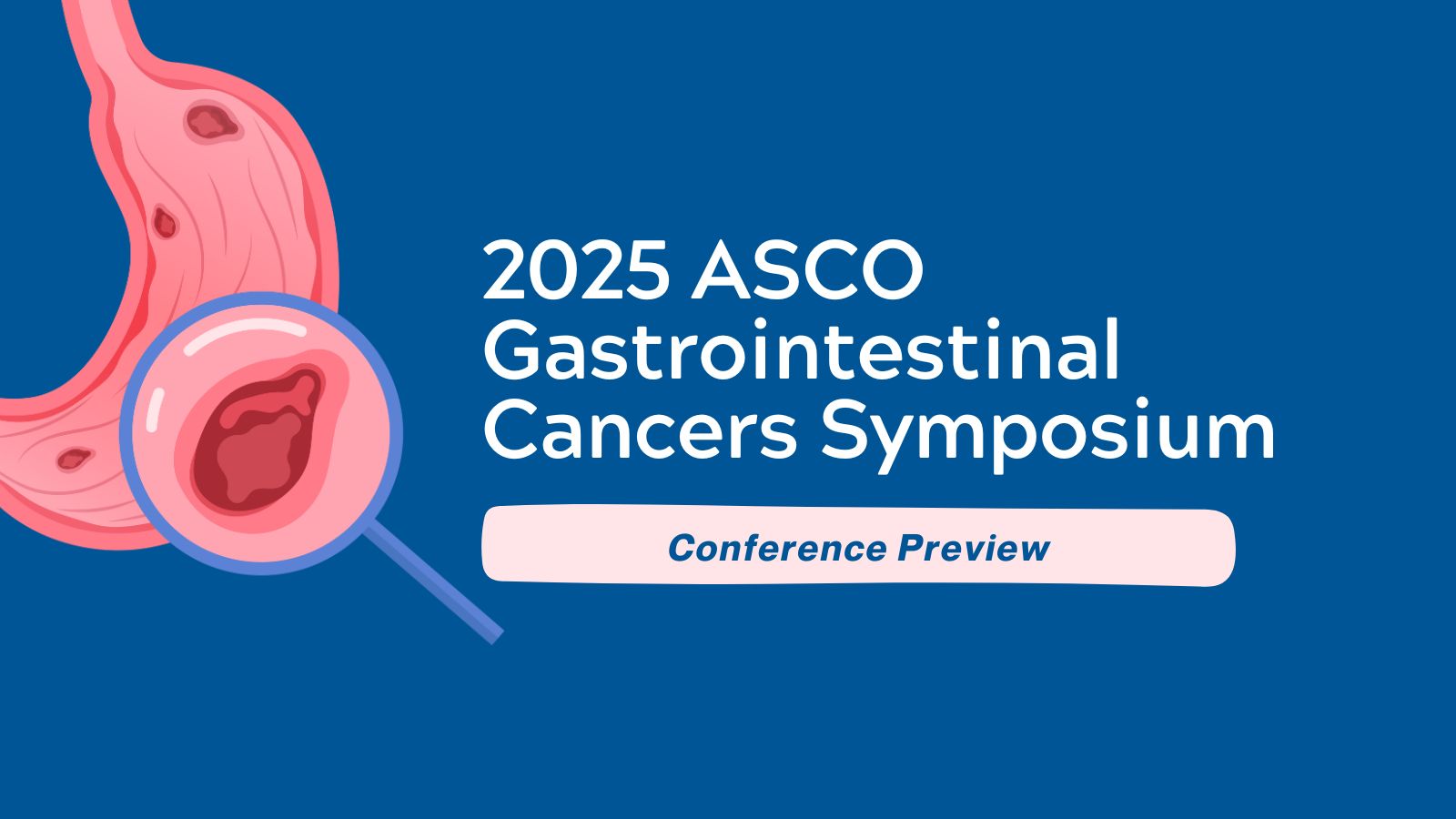 2025 ASCO Gastrointestinal Cancers Symposium - Conference Preview featured image