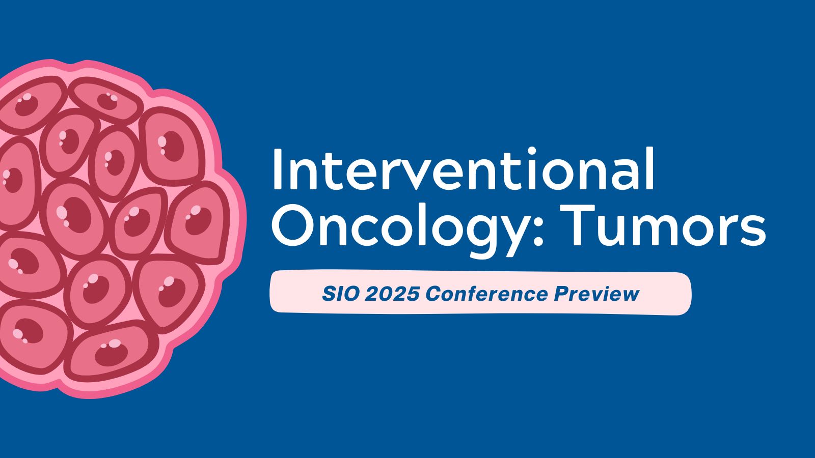 SIO 2025  - Conference Preview (Focus on Tumors) featured image